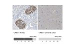 Immunohistochemistry analysis in human kidney and cerebral cortex tissues using HPA013835 antibody. Corresponding CRB3 RNA-seq data are presented for the same tissues.