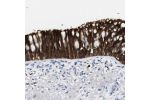 Immunohistochemical staining of human bronchus shows strong cytoplasmic positivity in respiratory epithelial cells.