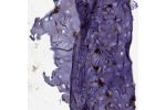 Immunohistochemical staining of human soft tissue shows strong cytoplasmic positivity in chondrocytes.