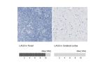 Immunohistochemistry analysis in human tonsil and cerebral cortex tissues using Anti-LAG3 antibody. Corresponding LAG3 RNA-seq data are presented for the same tissues.