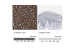 Immunohistochemistry analysis in human liver and skin tissues using HPA013970 antibody. Corresponding CYP2C8 RNA-seq data are presented for the same tissues.