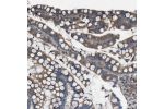 Immunohistochemical staining of human colon shows moderate cytoplasmic positivity in glandular cells.