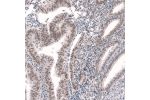 Immunohistochemical staining of human endometrium shows moderate nuclear positivity in glandular cells.