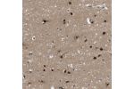 Immunohistochemical staining of human cerebral cortex shows strong nuclear positivity in neurons.