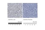 Immunohistochemistry analysis in human liver and pancreas tissues using HPA014044 antibody. Corresponding CLEC4G RNA-seq data are presented for the same tissues.