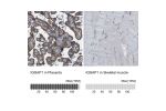 Immunohistochemistry analysis in human placenta and skeletal muscle tissues using HPA014055 antibody. Corresponding IQGAP1 RNA-seq data are presented for the same tissues.