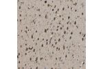 Immunohistochemical staining of human cerebral cortex shows strong cytoplasmic positivity in neurons.