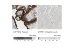 Immunohistochemistry analysis in human placenta and skeletal muscle tissues using HPA014067 antibody. Corresponding ENTPD1 RNA-seq data are presented for the same tissues.