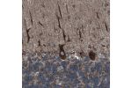 Immunohistochemical staining of human cerebellum shows strong granular cytoplasmic positivity in Purkinje cells.