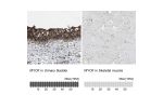 Immunohistochemistry analysis in human urinary bladder and skeletal muscle tissues using HPA014245 antibody. Corresponding MYOF RNA-seq data are presented for the same tissues.