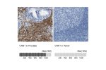 Immunohistochemistry analysis in human prostate and tonsil tissues using HPA014263 antibody. Corresponding CNN1 RNA-seq data are presented for the same tissues.
