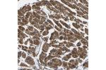 Immunohistochemical staining of human heart muscle shows moderate cytoplasmic positivity in cardiomyocytes.