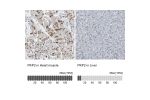 Immunohistochemistry analysis in human heart muscle and liver tissues using HPA014314 antibody. Corresponding PKP2 RNA-seq data are presented for the same tissues.