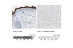 Immunohistochemistry analysis in human skin and skeletal muscle tissues using Anti-KLK5 antibody. Corresponding KLK5 RNA-seq data are presented for the same tissues.