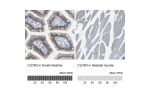 Immunohistochemical staining of human duodenum shows strong membranous positivity in glandular cells.