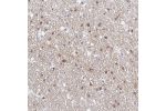 Immunohistochemical staining of human hippocampus shows moderate cytoplasmic positivity in glial cells.