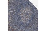Immunohistochemical staining of human lymph node shows moderate cytoplasmic positivity in germinal center cells and non-germinal center cells.
