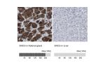 Immunohistochemistry analysis in human adrenal gland and liver tissues using HPA014404 antibody. Corresponding SNCG RNA-seq data are presented for the same tissues.