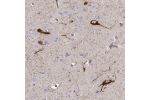 Immunohistochemical staining of human cerebral cortex shows strong staining in synapses and cytoplasmic positivity in a subset of neuronal cells.