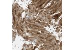 Immunohistochemical staining of human heart muscle shows moderate cytoplasmic positivity in cardiomyocytes.
