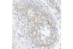 Immunohistochemical staining of human testis shows moderate membranous positivity in cells in seminiferous ducts.