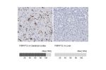 Immunohistochemistry analysis in human cerebral cortex and liver tissues using HPA014518 antibody. Corresponding P2RY12 RNA-seq data are presented for the same tissues.
