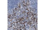 Immunohistochemical staining of human spleen shows strong cytoplasmic positivity in cells in red pulp.