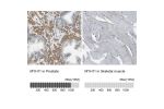 Immunohistochemistry analysis in human prostate and skeletal muscle tissues using Anti-MYH11 antibody. Corresponding MYH11 RNA-seq data are presented for the same tissues.