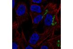 Immunofluorescent staining of human cell line SK-MEL-30 shows localization to the Golgi apparatus.