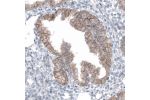 Immunohistochemical staining of human endometrium shows moderate to strong membranous positivity in glandular cells.