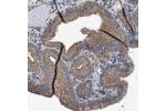 Immunohistochemical staining of human gall bladder shows strong cytoplasmic positivity in glandular cells.