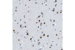 Immunohistochemical staining of human cerebral cortex shows strong nuclear positivity in neuronal cells.