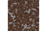 Immunohistochemical staining of human pancreas shows strong cytoplasmic positivity in exocrine glandular cells.