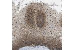 Immunohistochemical staining of human esophagus shows membranous positivity in squamous epithelial cells.