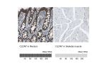 Immunohistochemistry analysis in human rectum and skeletal muscle tissues using Anti-CLDN7 antibody. Corresponding CLDN7 RNA-seq data are presented for the same tissues.