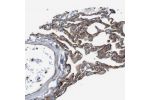 Immunohistochemical staining of human lung shows moderate to strong cytoplasmic positivity in pneumocytes.