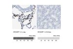 Immunohistochemistry analysis in human lung and kidney tissues using HPA014731 antibody. Corresponding MCEMP1 RNA-seq data are presented for the same tissues.