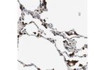 Immunohistochemical staining of human lung shows strong granular cytoplasmic positivity in macrophages.