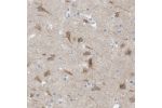 Immunohistochemical staining of human cerebral cortex shows weak to moderate cytoplasmic positivity in neurons.