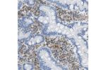 Immunohistochemical staining of human corpus, uterine shows strong membranous and cytoplasmic positivity in glandular cells.