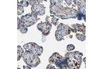 Immunohistochemical staining of human placenta shows moderate membranous positivity in erythrocytes.