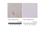 Immunohistochemistry analysis in human cerebral cortex and skeletal muscle tissues using HPA014850 antibody. Corresponding NEFL RNA-seq data are presented for the same tissues.