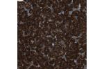 Immunohistochemical staining of human pancreas shows strong cytoplasmic positivity in exocrine glandular cells.