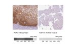 Immunohistochemistry analysis in human esophagus and skeletal muscle tissues using HPA014924 antibody. Corresponding AQP3 RNA-seq data are presented for the same tissues.