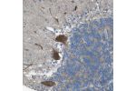 Immunohistochemical staining of human Cerebellum shows strong granular cytoplasmic positivity in Purkinje cells.