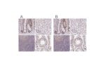 Immunohistochemical staining of human gastrointestinal, kidney, lymphoid tissues and testis using Anti-PTPN2 antibody HPA015004 (A) shows similar protein distribution across tissues to independent antibody HPA046176 (B).