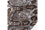 Immunohistochemical staining of human colon shows strong cytoplasmic positivity in glandular cells.