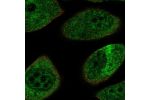 Immunofluorescent staining of human cell line PC-3 shows localization to nuclear speckles & intermediate filaments.
