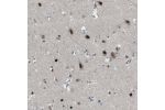 Immunohistochemical staining of human cerebral cortex shows strong nuclear positivity in neurons and glial cells.