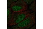 Immunofluorescent staining of human cell line U-2 OS shows localization to nucleoplasm & cytosol.